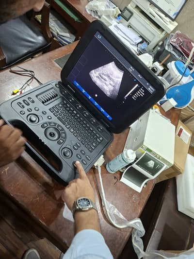 Ultrasound Machine / High Quality Ultrasound Machine