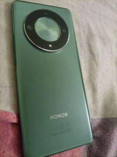 Honor X9b