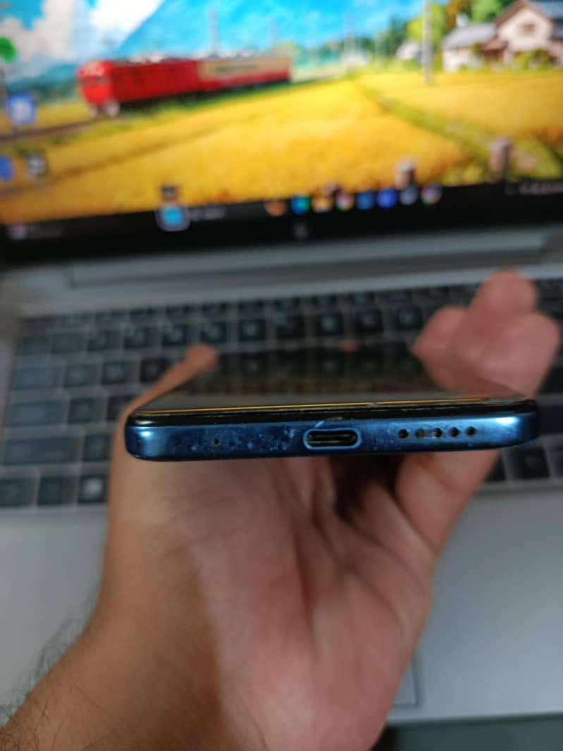 Xiaomi Redmi Note 11 3