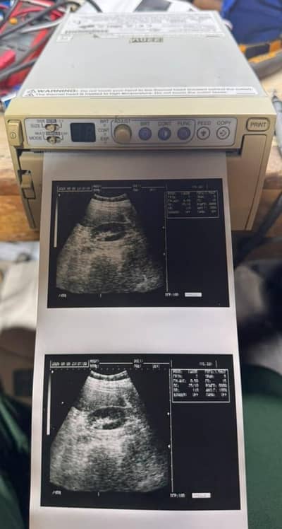 ultrasound printer