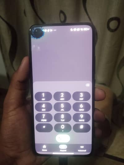 mi 11 lite all parts available
