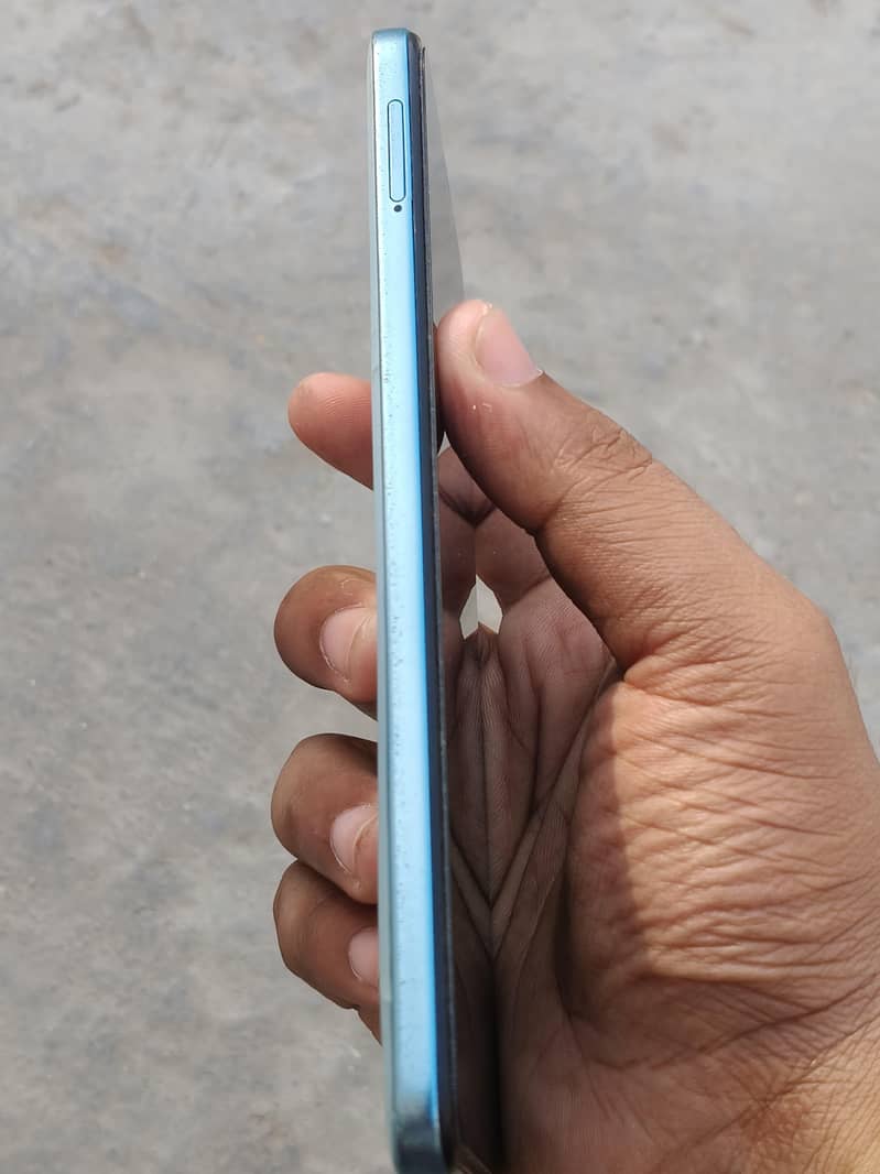 Xiaomi Redmi Note 11 3