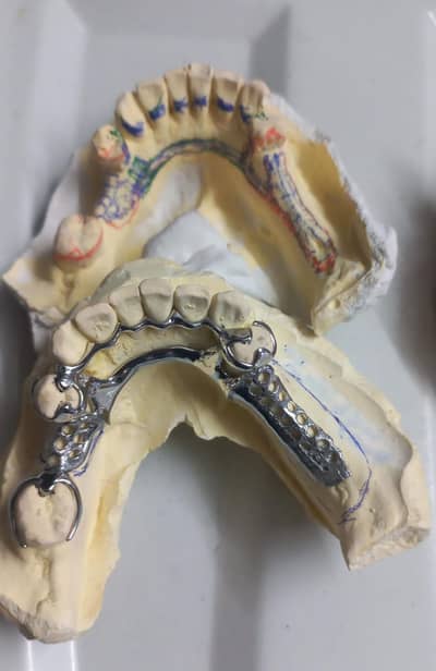 need of dental assistant