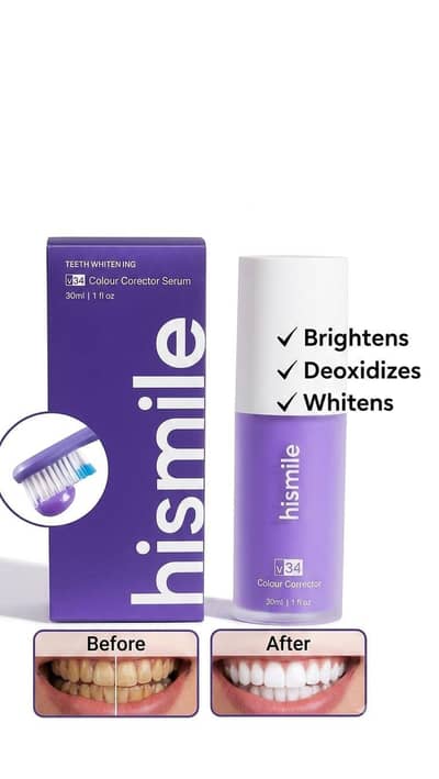Hismile Teeth whitening