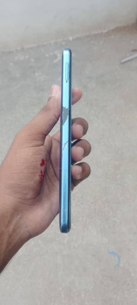 Xiaomi Redmi Note 11 3