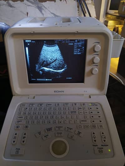 ultrasound machine