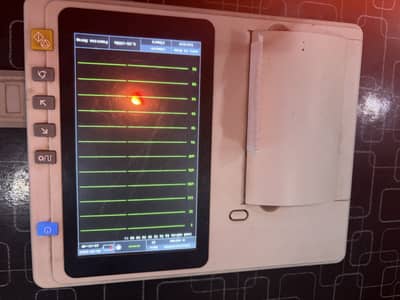 ECG Machine Ai reporting
