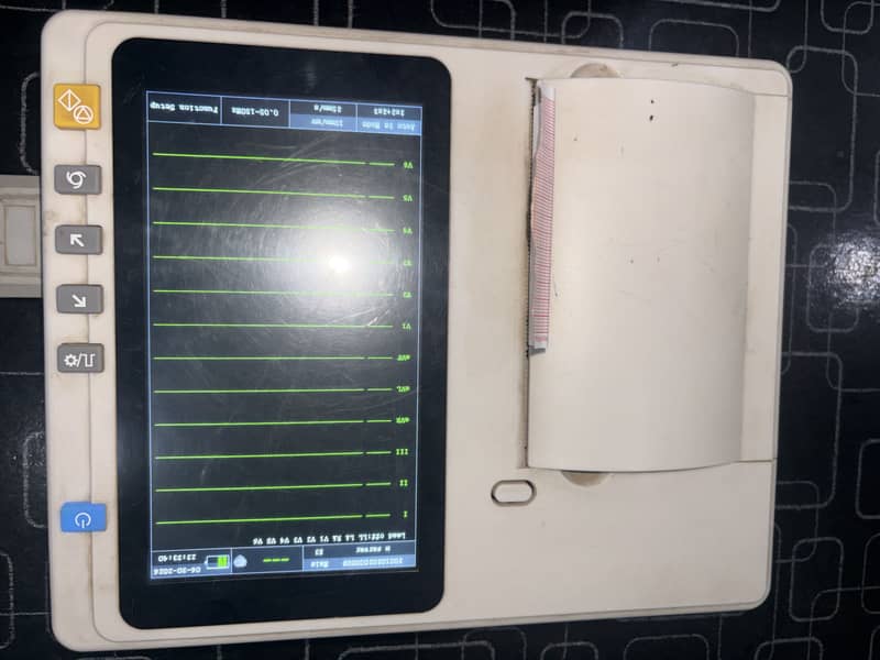 ECG Machine Ai reporting 3
