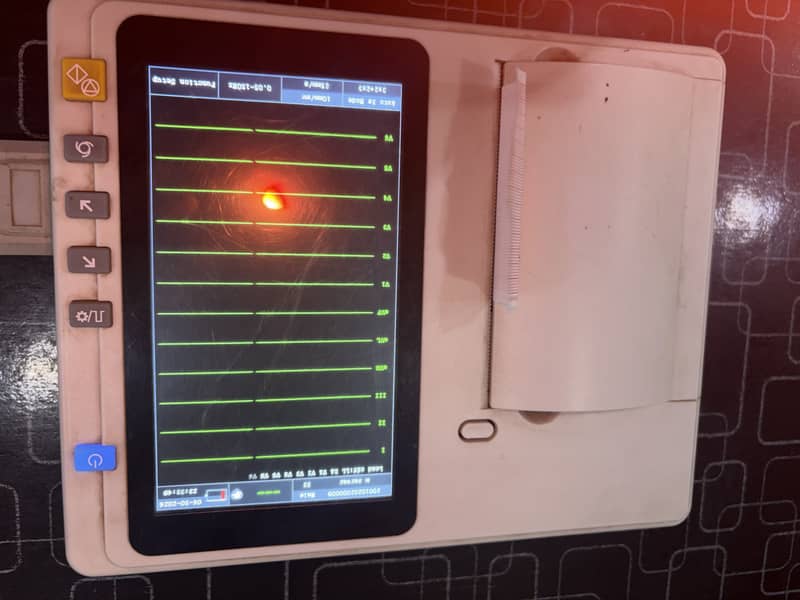 ECG machine AI reporting updated model 2