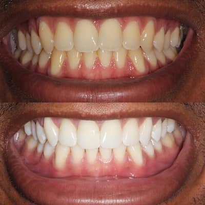 Female dental assistant required