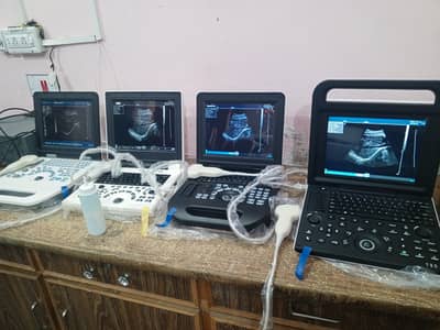 Used & New Chinese ultrasound machine (with or without battery backup)