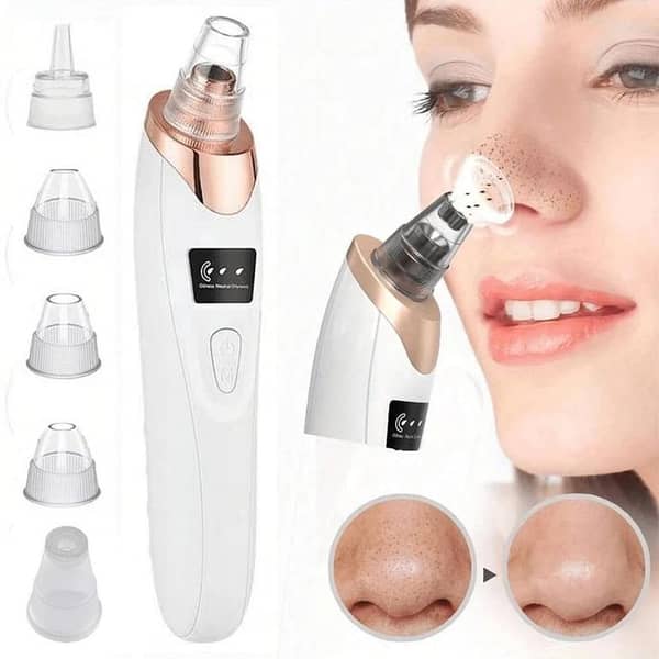 5-in-1 Electric Blackhead Remover Vacuum – Rechargeable Pore Cleaner with Acne Extractor, Whitehead Suction, Facial Skin Treatment & Deep Cleansing Tool
