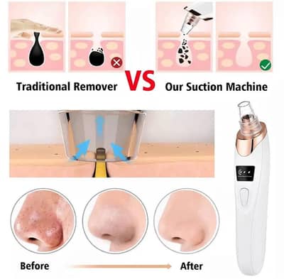 blackheads remover