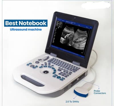 Hot Sale notebook Portable Ultrasound Scanner NYRO 10 Utltasound
