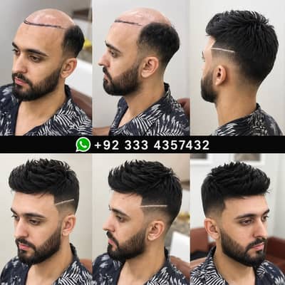 Premium Hair Patches & Wigs | Hair patch |Hair Wigs | wigs unit Women