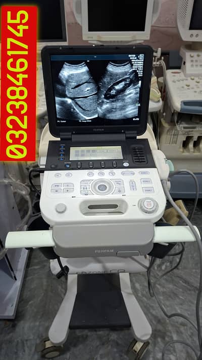 Fuji Fazon CB battery backup ultrasound machine