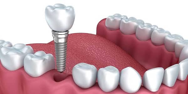 male dental assistant job