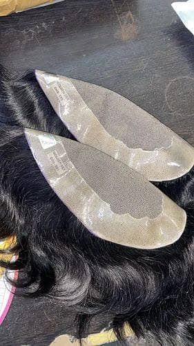 hair patch available 1