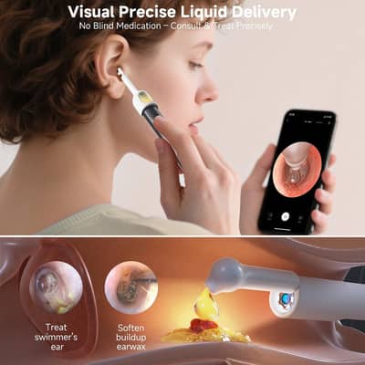Smart Visual Ear Cleaner Tool 