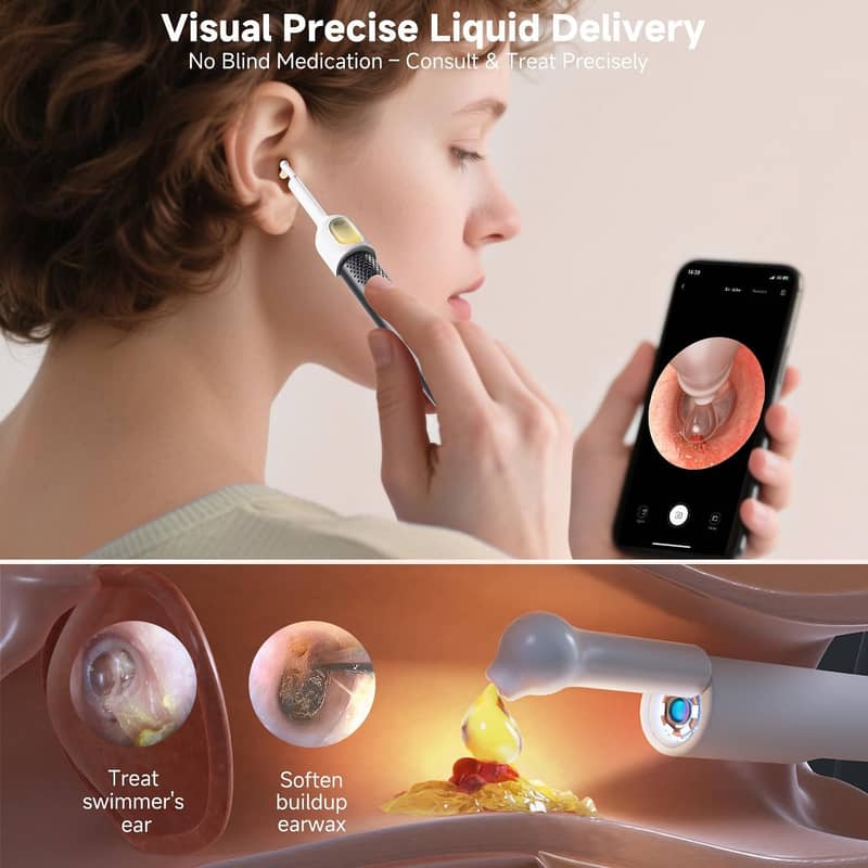 Smart Visual Ear Cleaner Tool  0