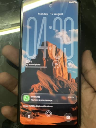 Xiaomi Other Model