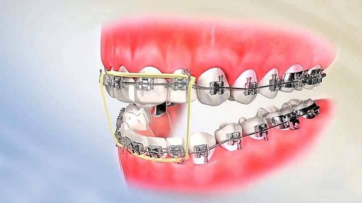 dentist required 1