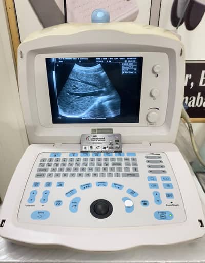 MINDRAY DP-1100PLUS ULTRASOUND MACHINE