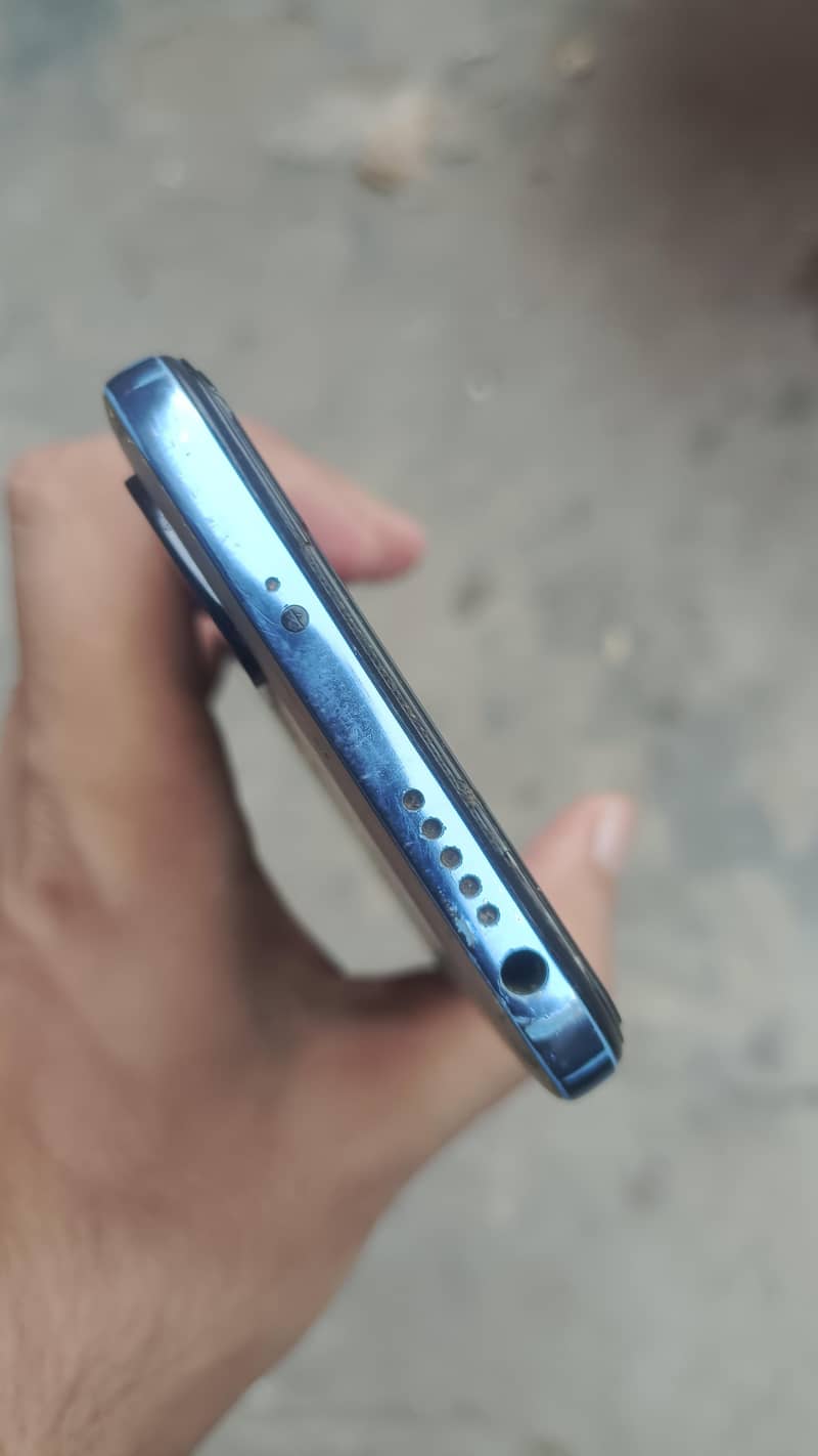 Xiaomi Redmi Note 11 3