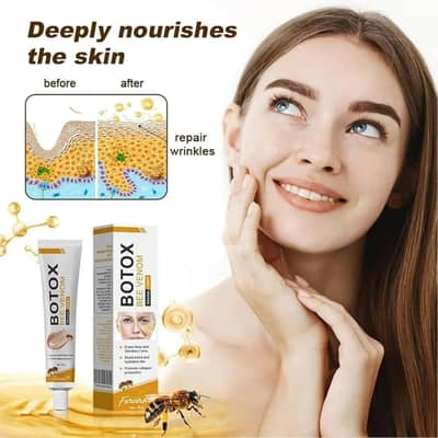 Acne Scar Removal Cream 30ml – Helps Reduce Acne Marks & Scars | For A