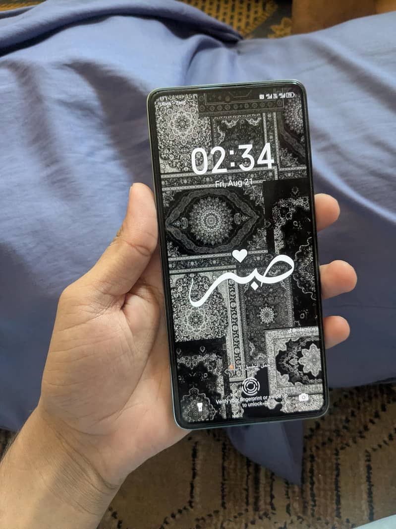 Tecno CAMON 20 1