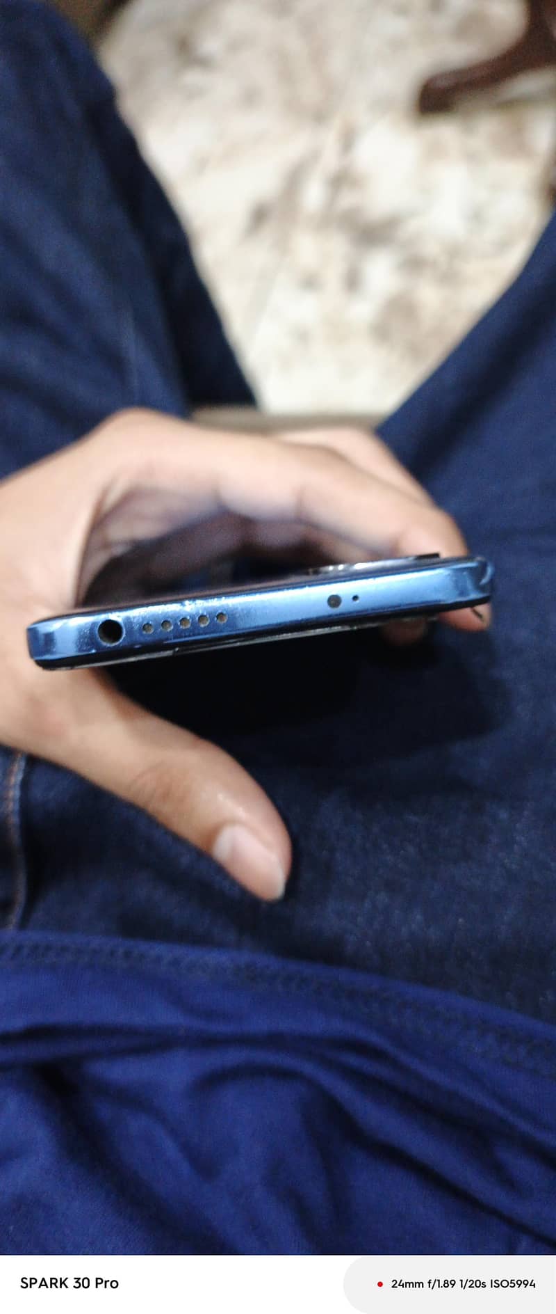 Xiaomi Redmi Note 11 3