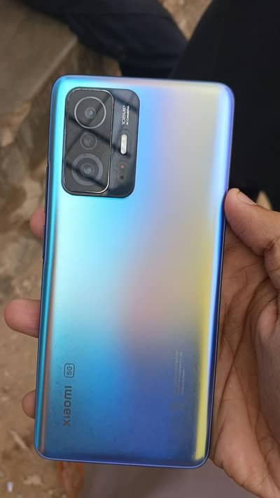 Xiaomi 11T note sell only exchange best phones