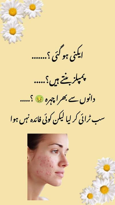 Acne treatment products