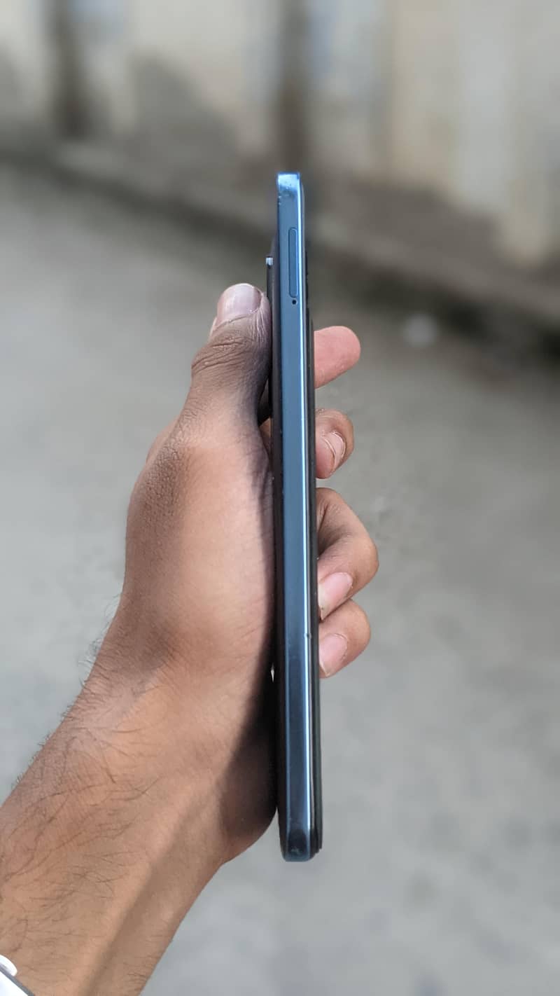 Redmi note 11 3