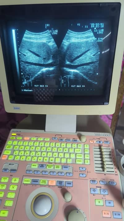 ultrasound machine aloka 1000