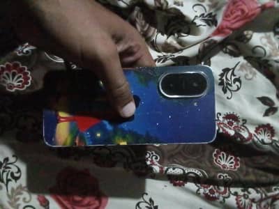 Xiaomi A5