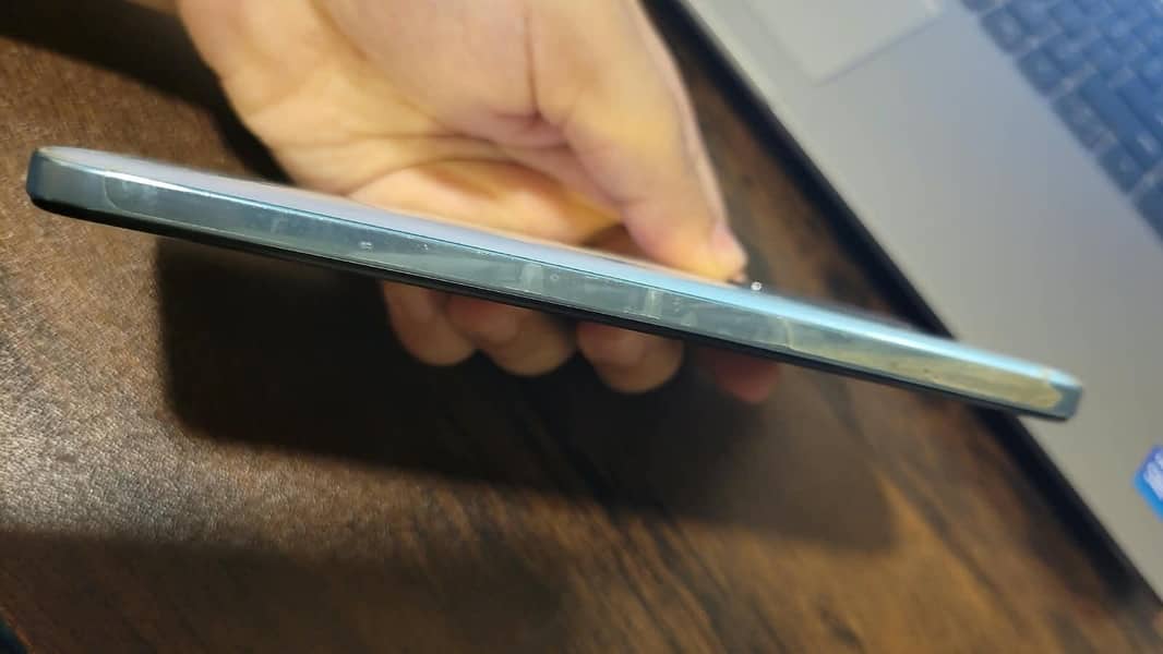Xiaomi Redmi Note 11 4
