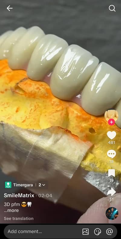 need female dental lab wokers