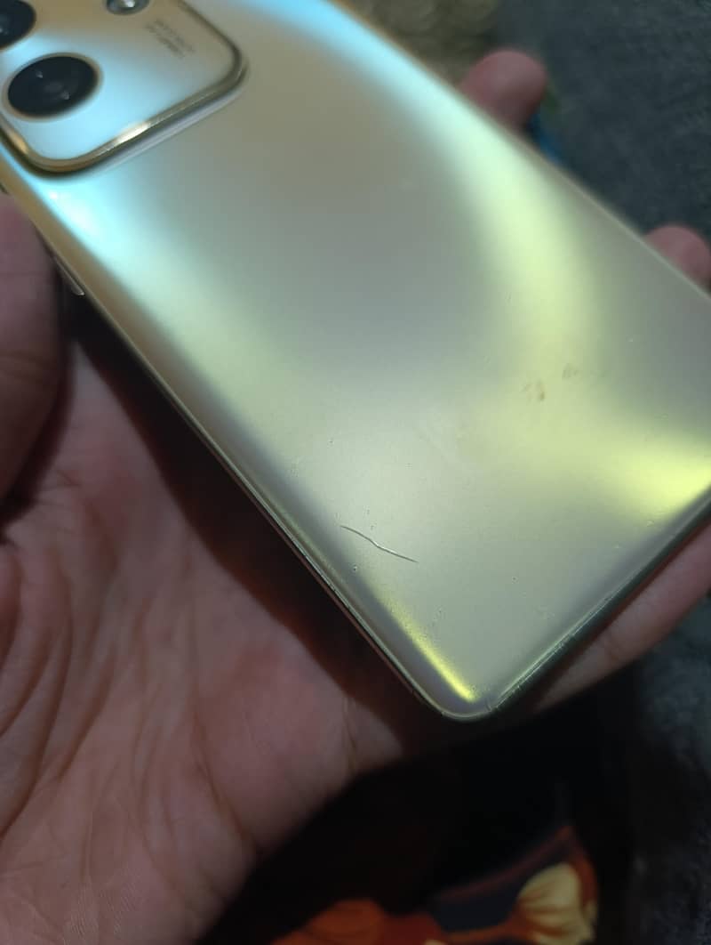 Infinix Zero 30 1