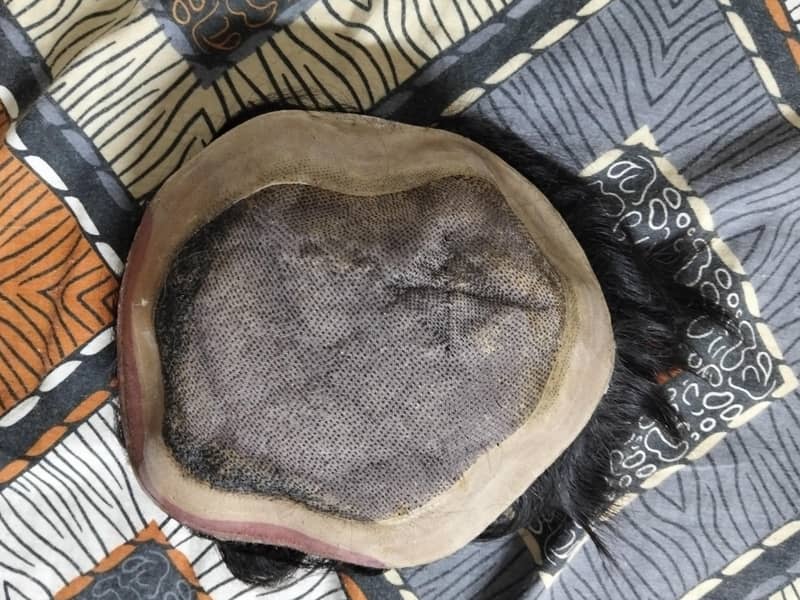 Hair Patch 2