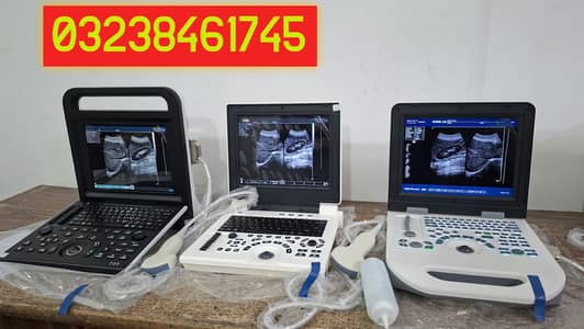 new china battery backup ultrasound machine with 18 month warranty