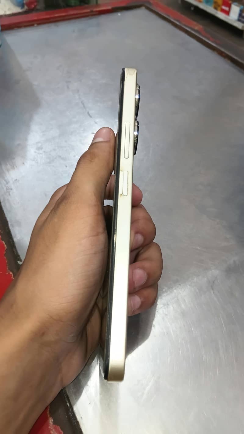 Redmi 31 3