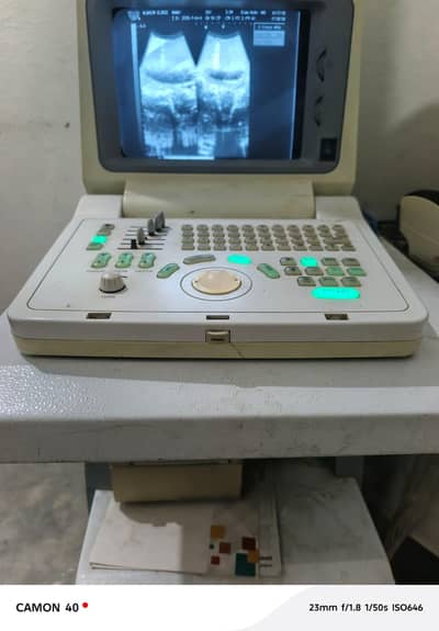 Ultra Sound machine