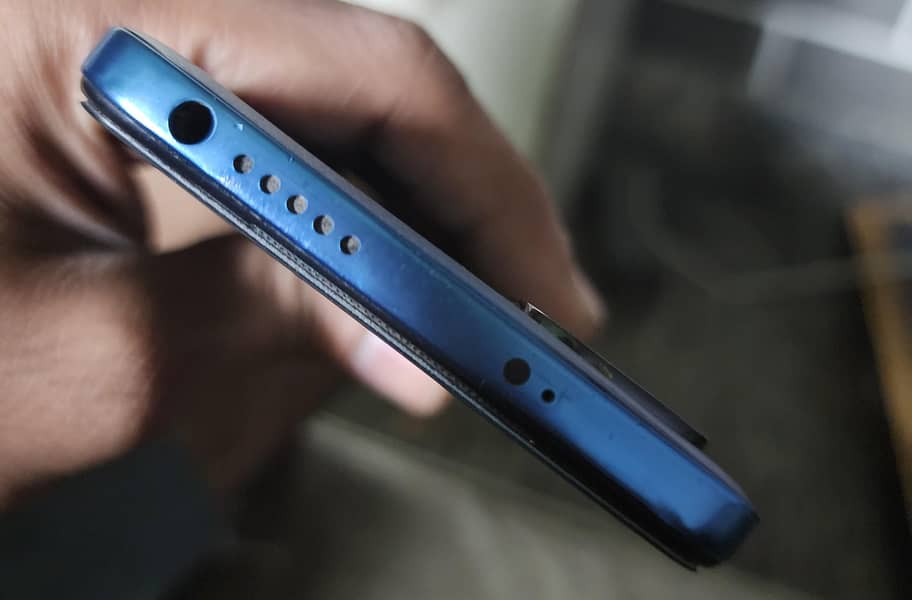 Xiaomi Redmi Note 11 6