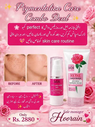 SCS Rose Face Wash and Anti malasma gel