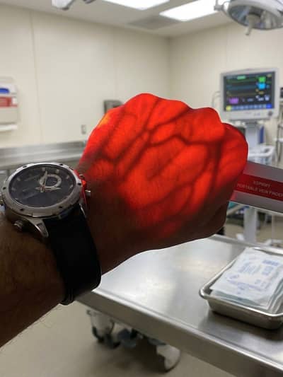 Infrared Vein Finder - Portable Medical Device