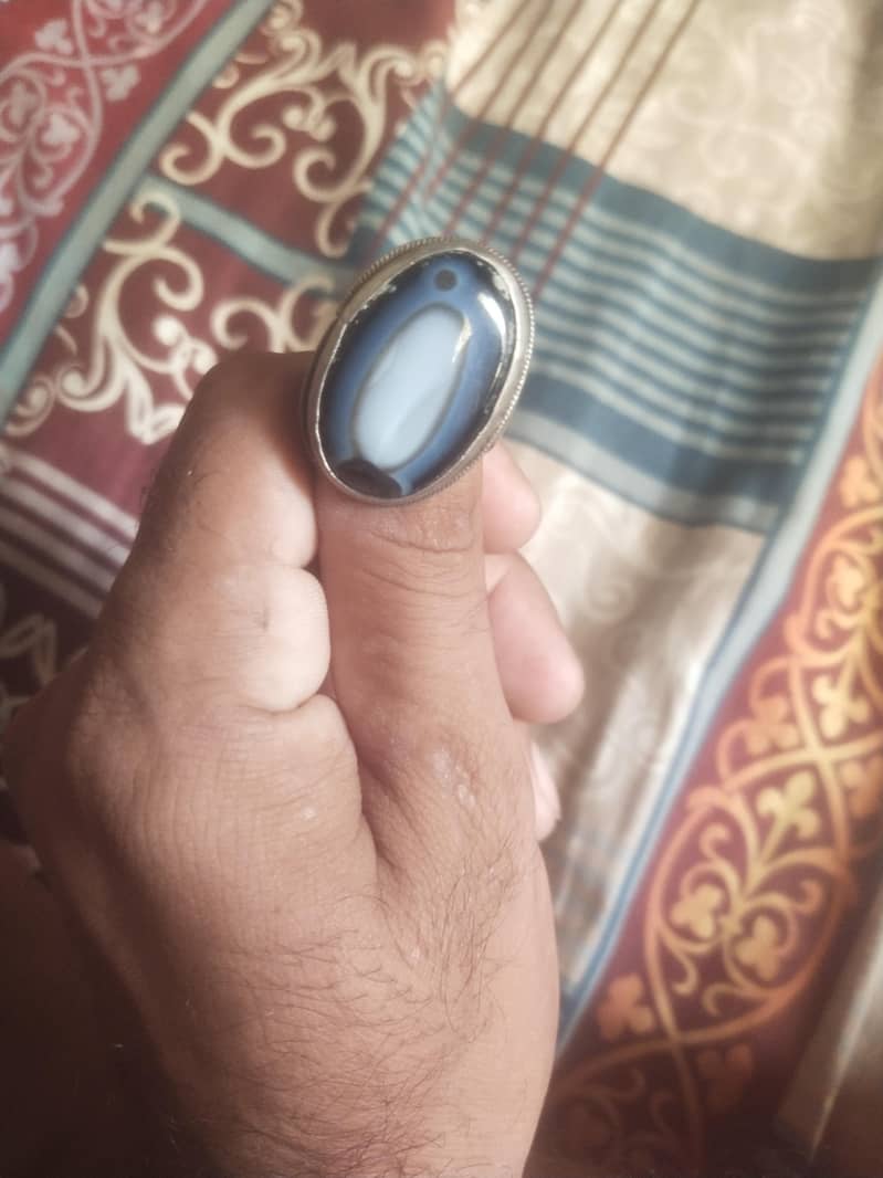 seton ring 3