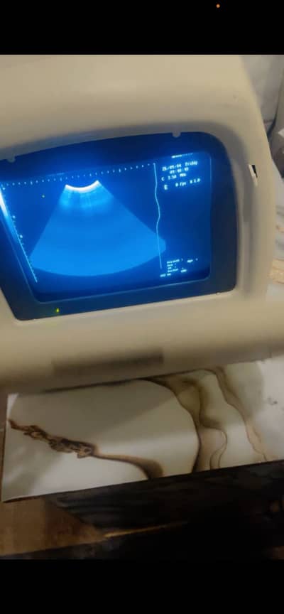 Diagnostic Ultrasound