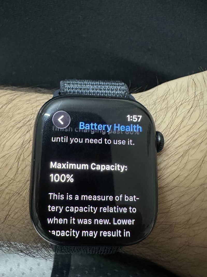Apple watch 1