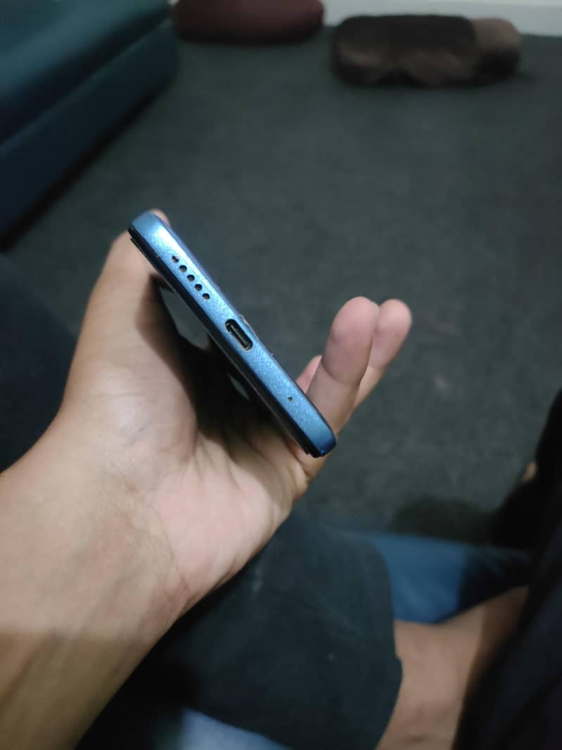 Redmi note 11 3